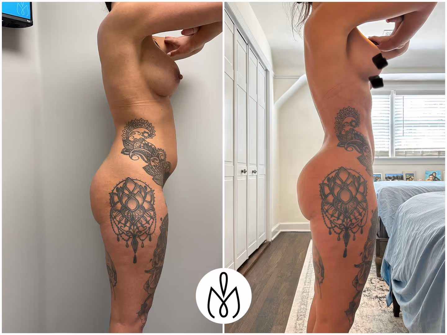 Before,After