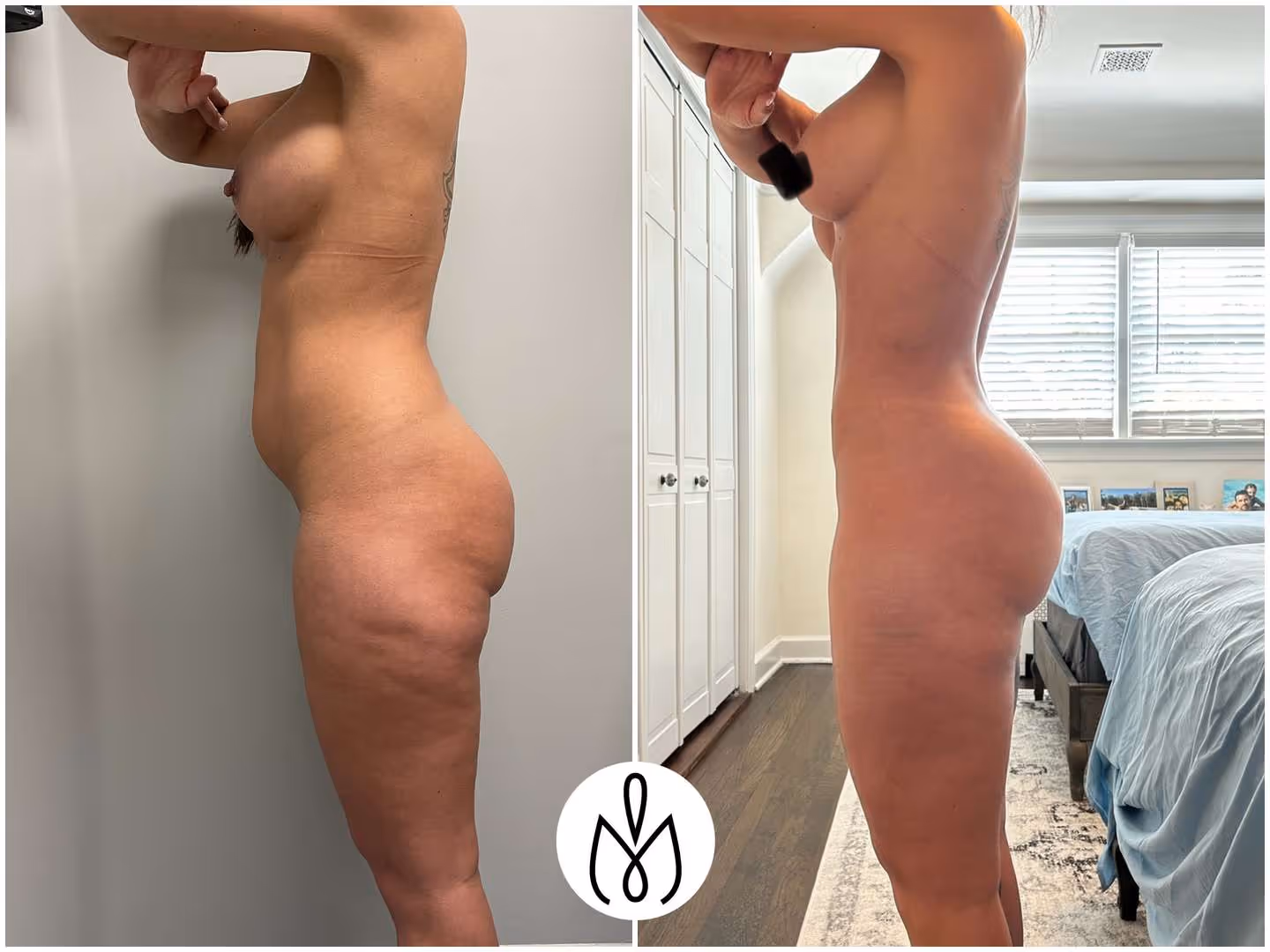 Before,After