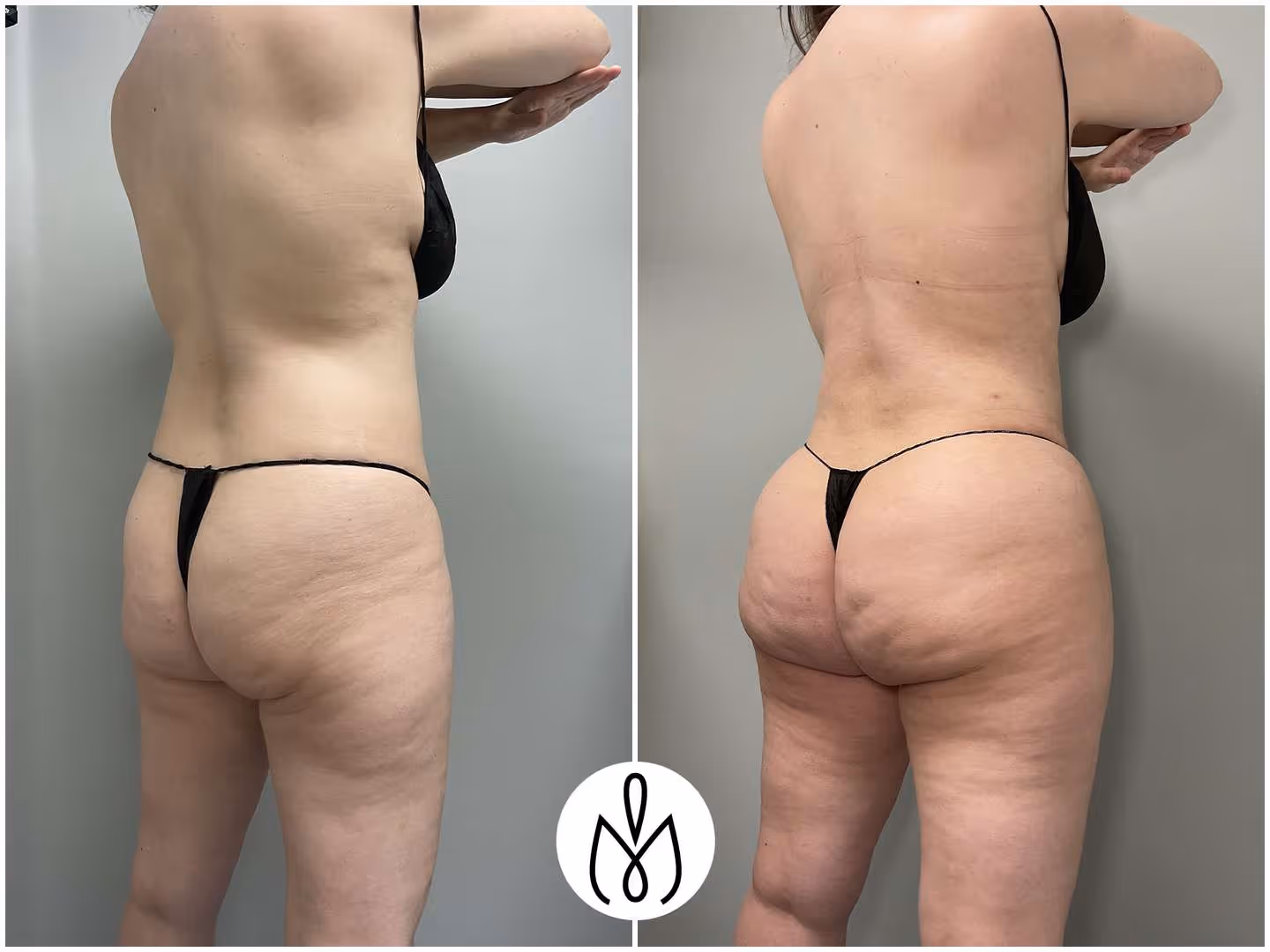 Before,After