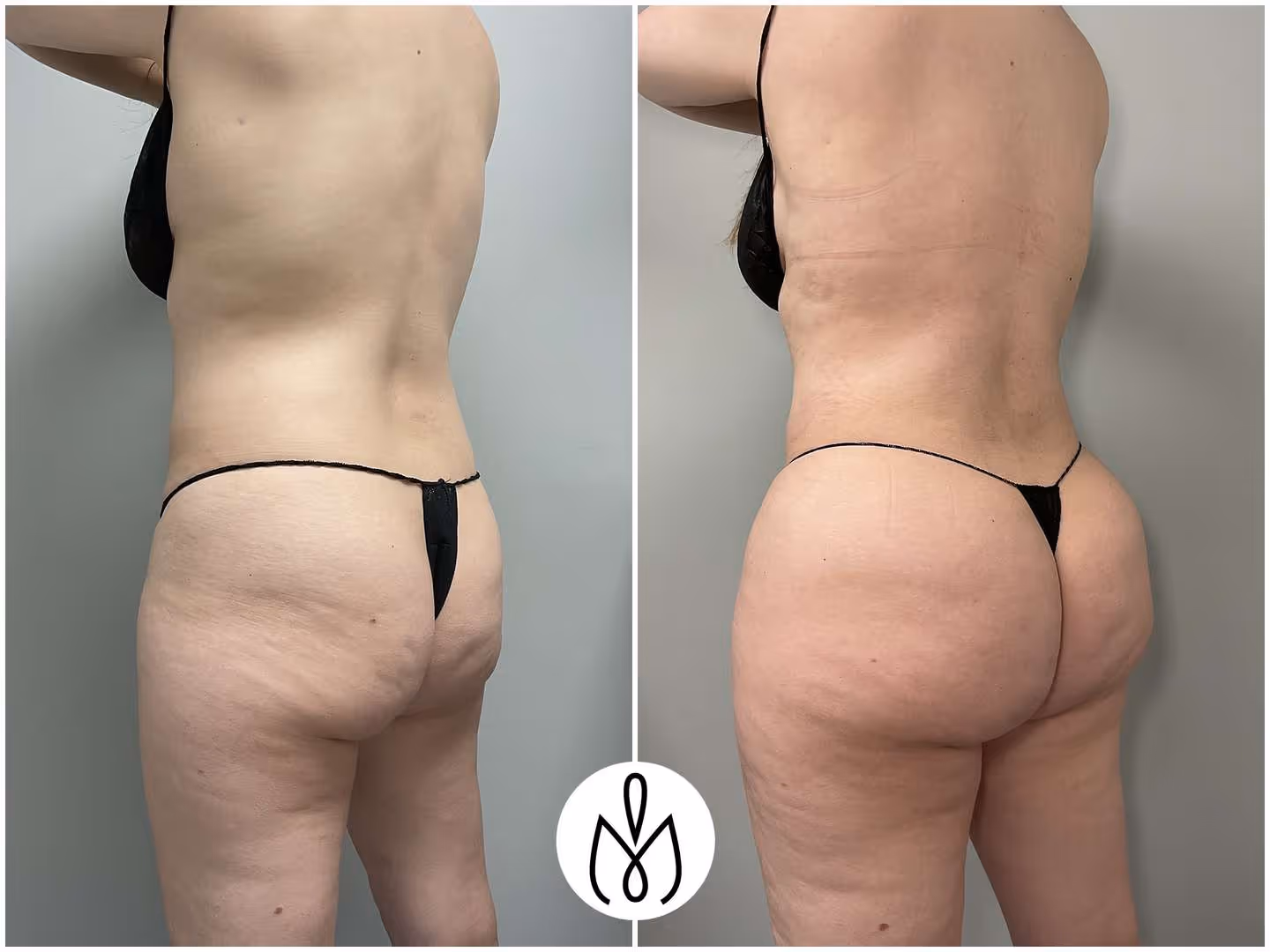 Before,After