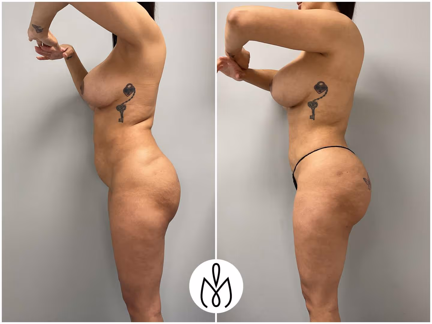 Before,After