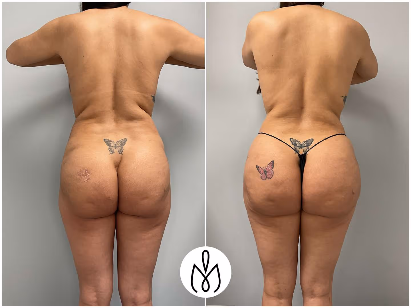 Before,After