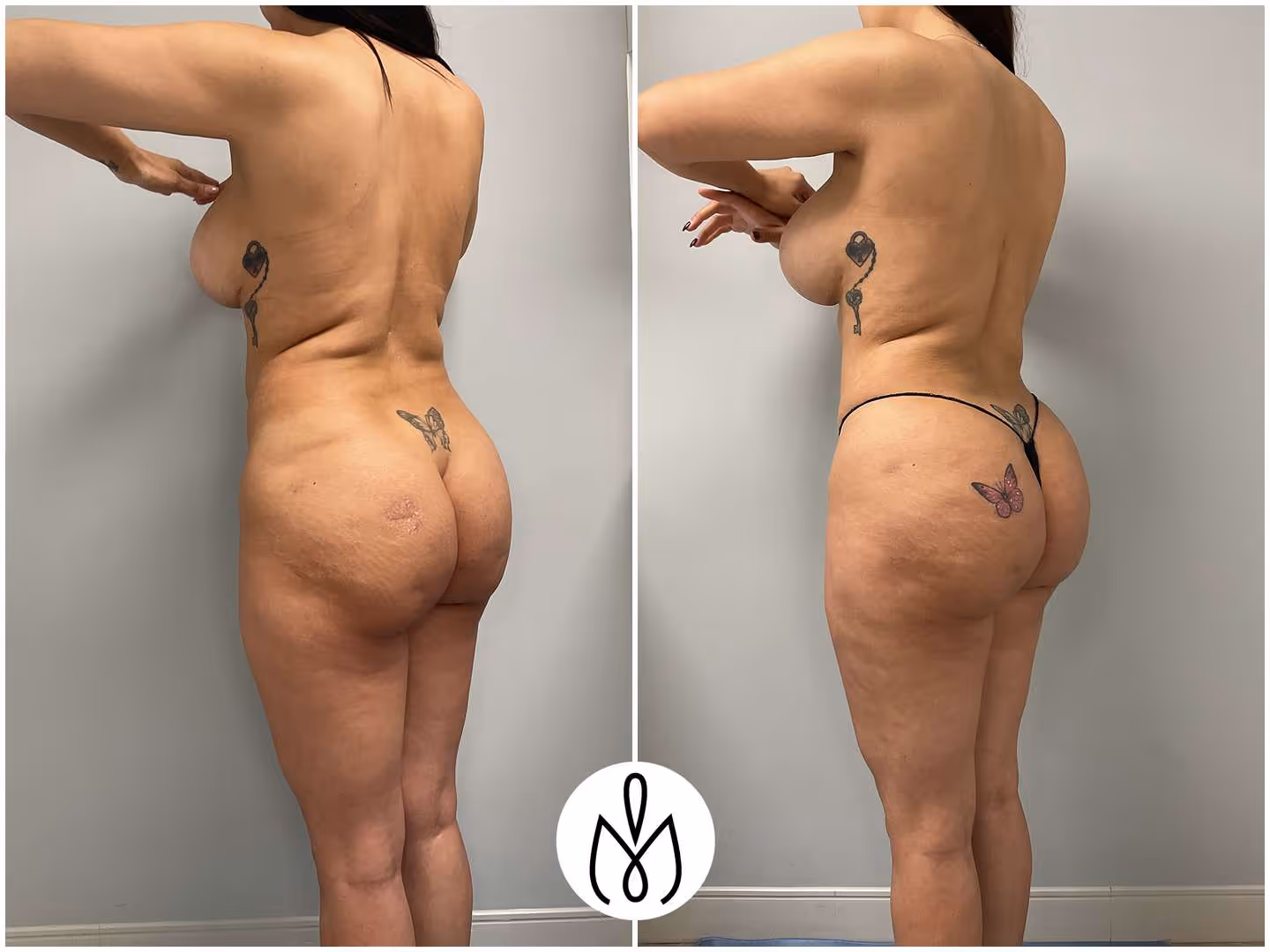 Before,After