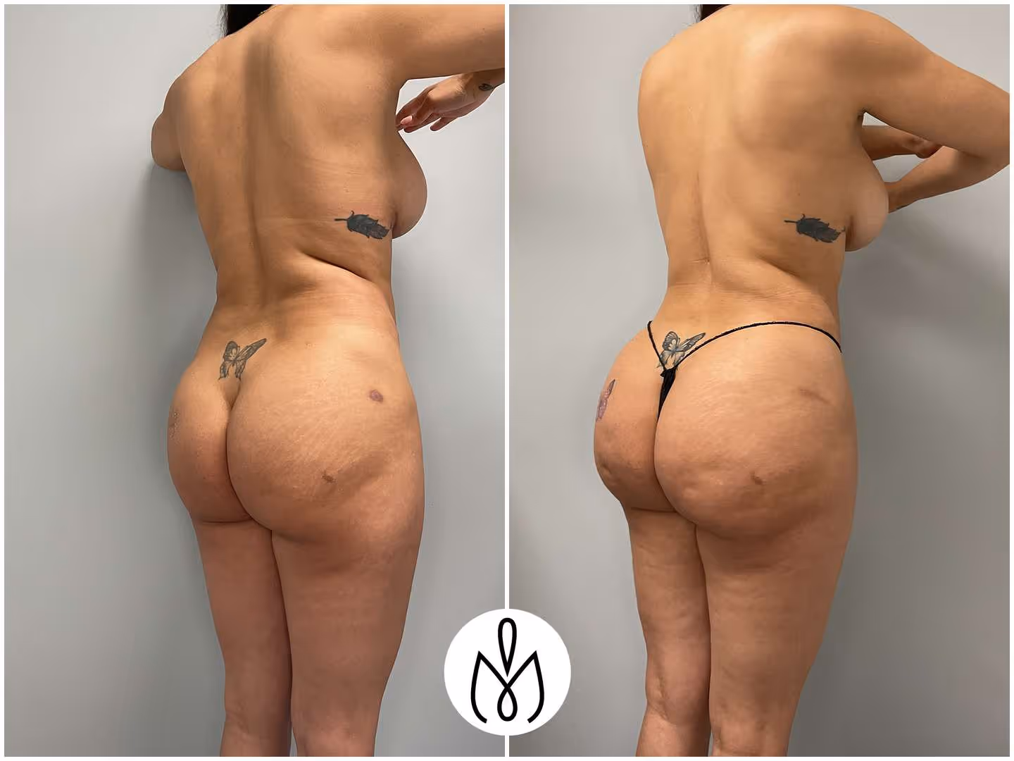 Before,After