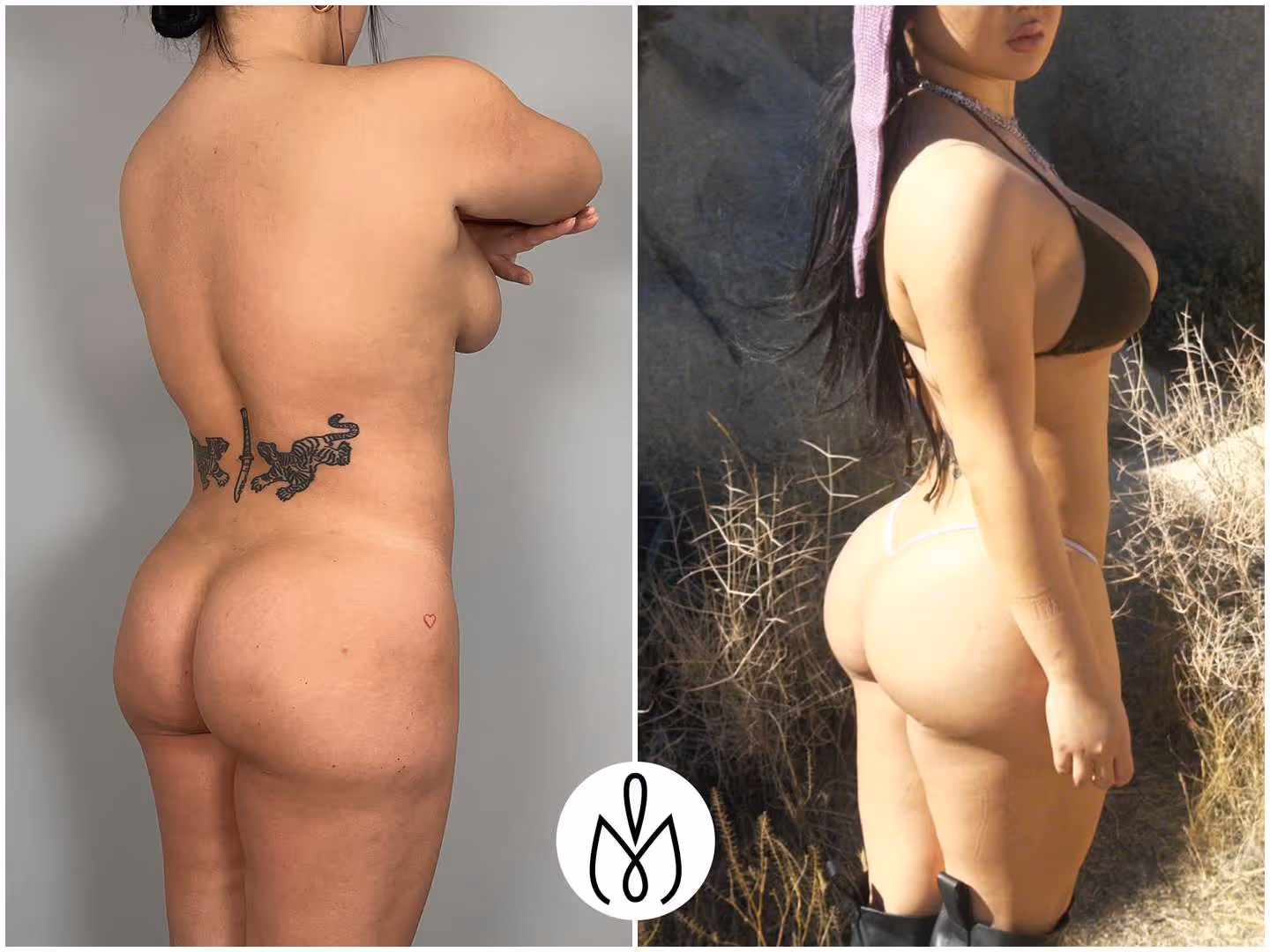 Before,After