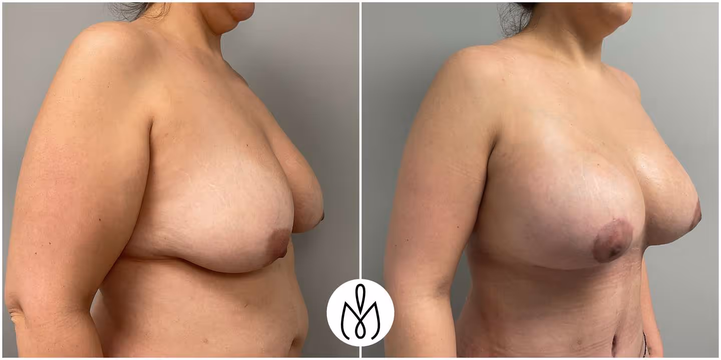 Before,After
