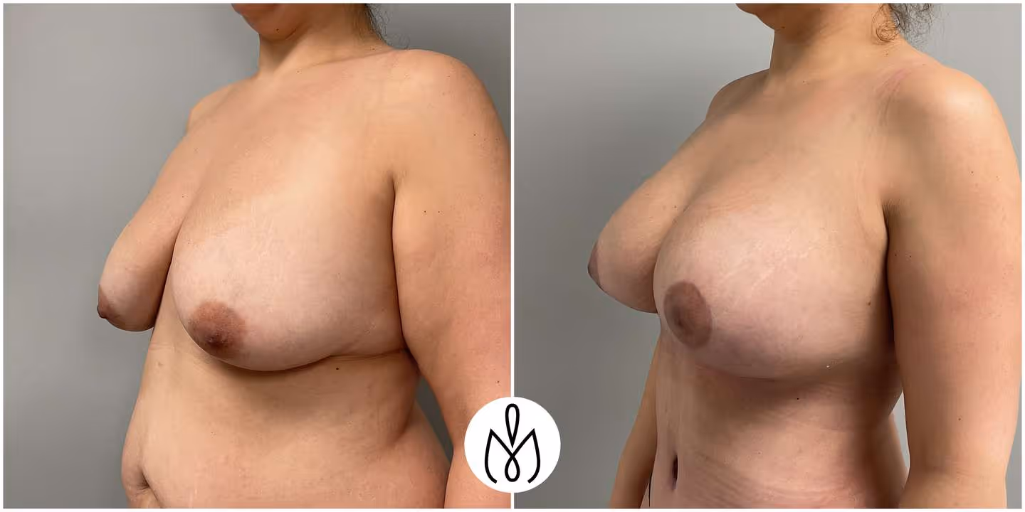 Before,After
