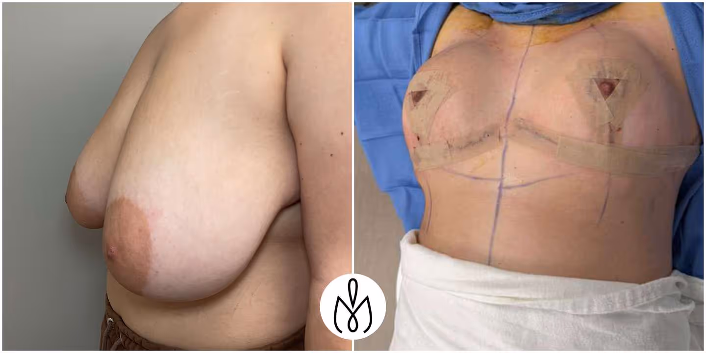 Before,After