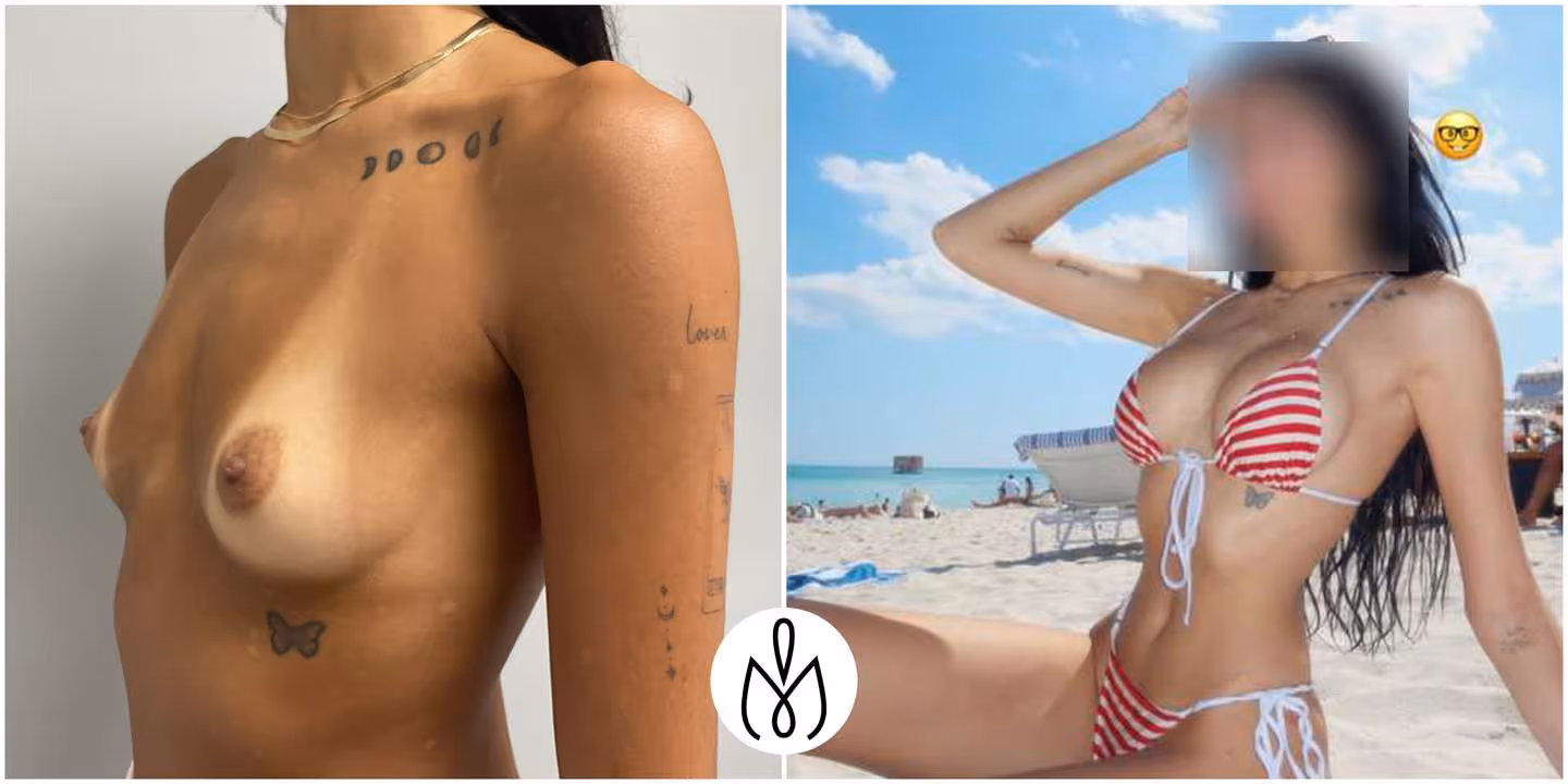 Before,After