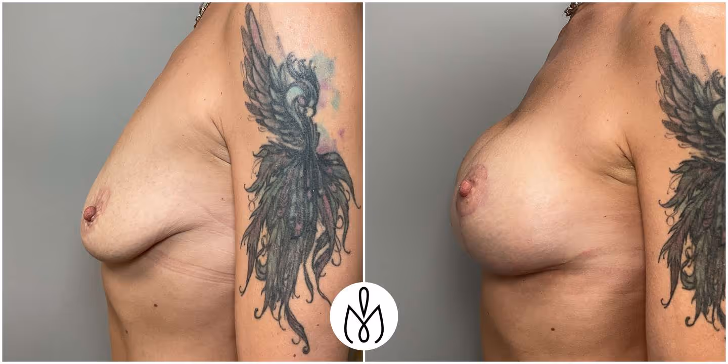 Before,After