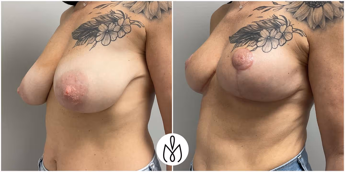 Before,After