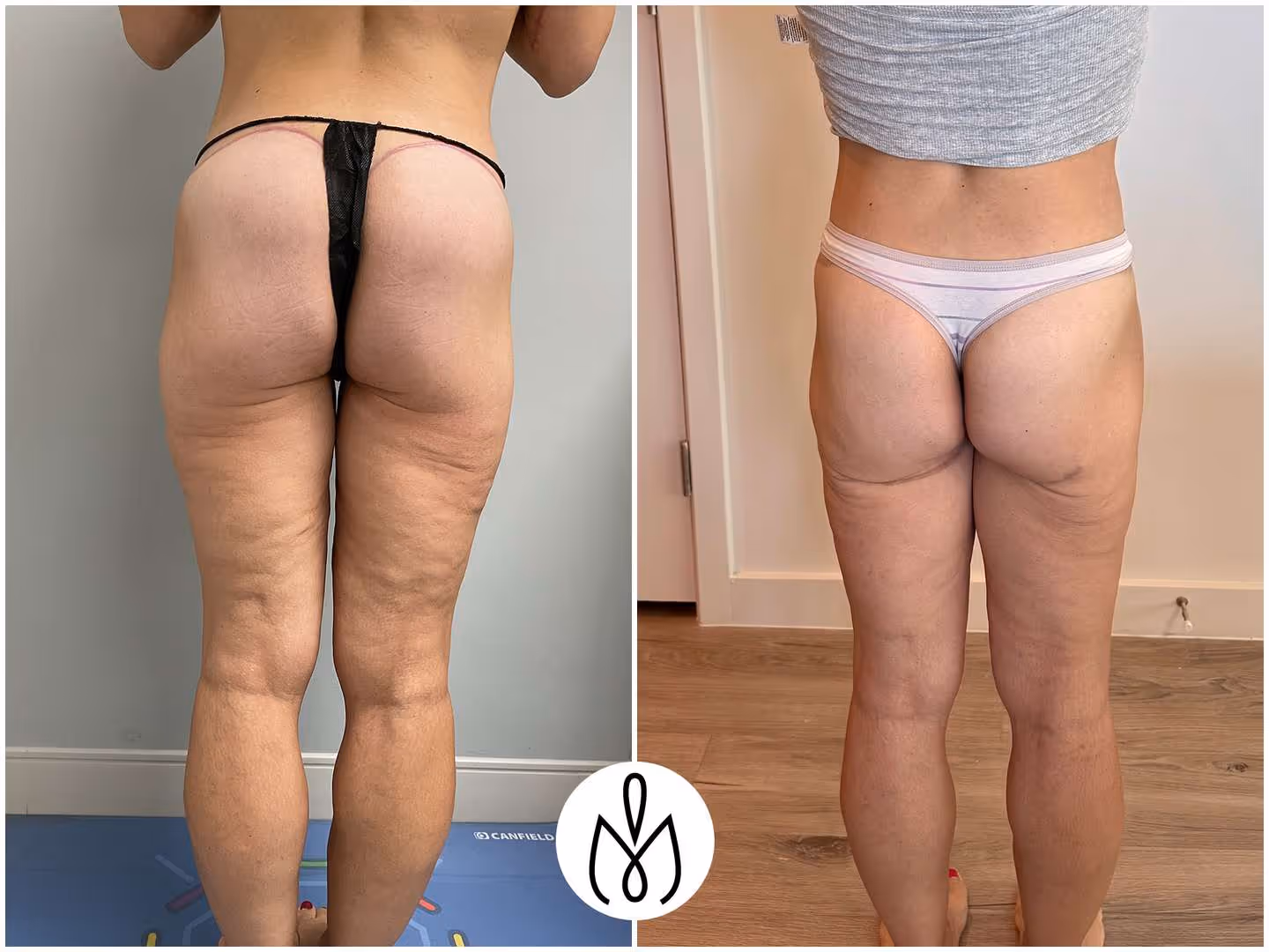 Before,After