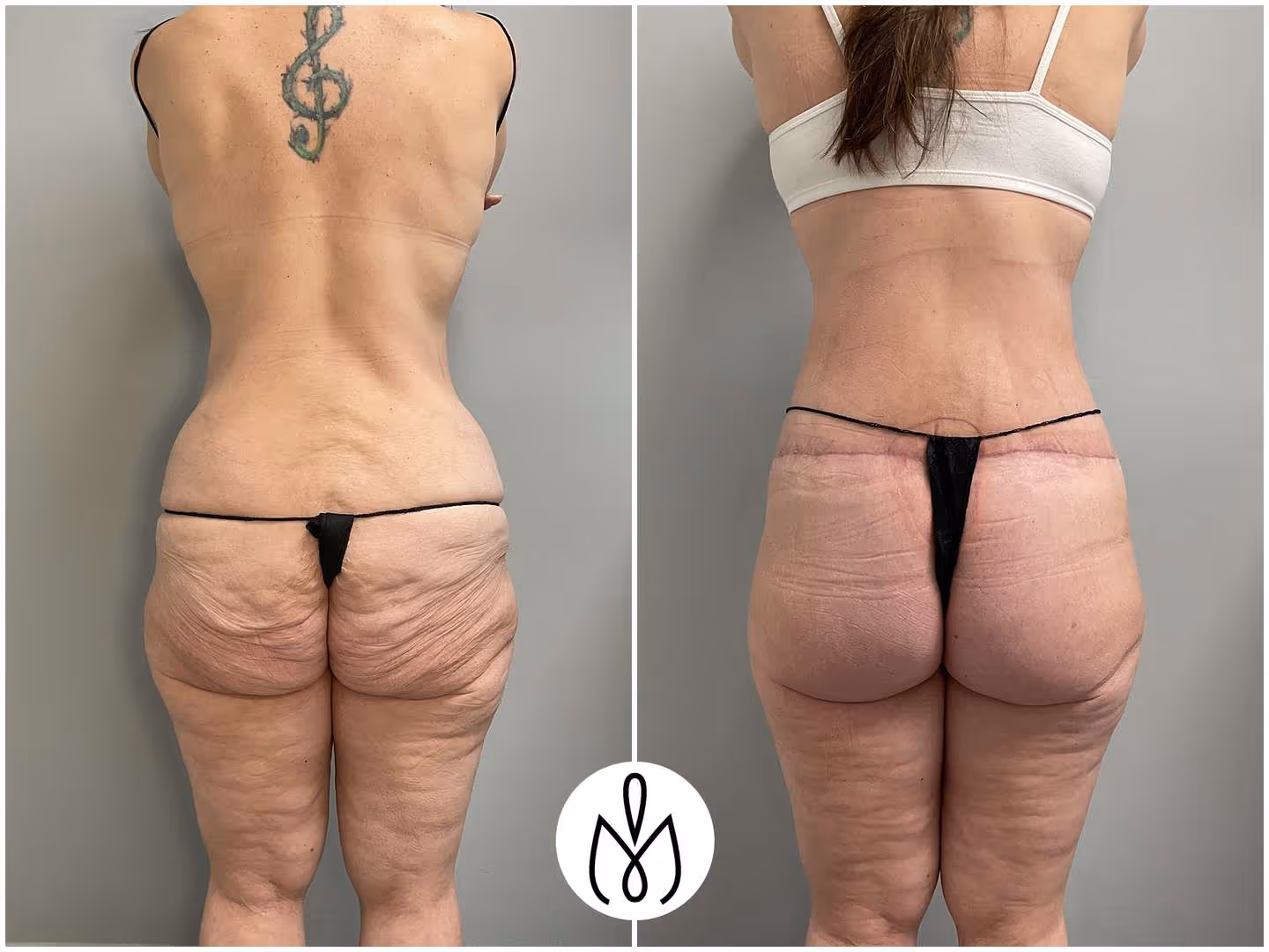 Before,After