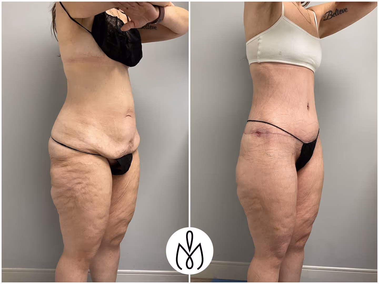 Before,After