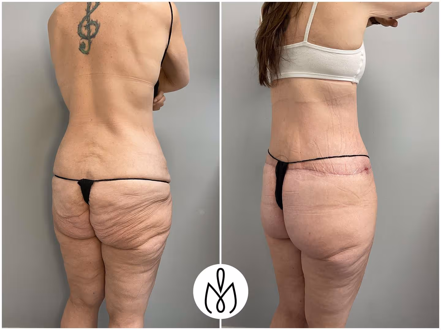 Before,After
