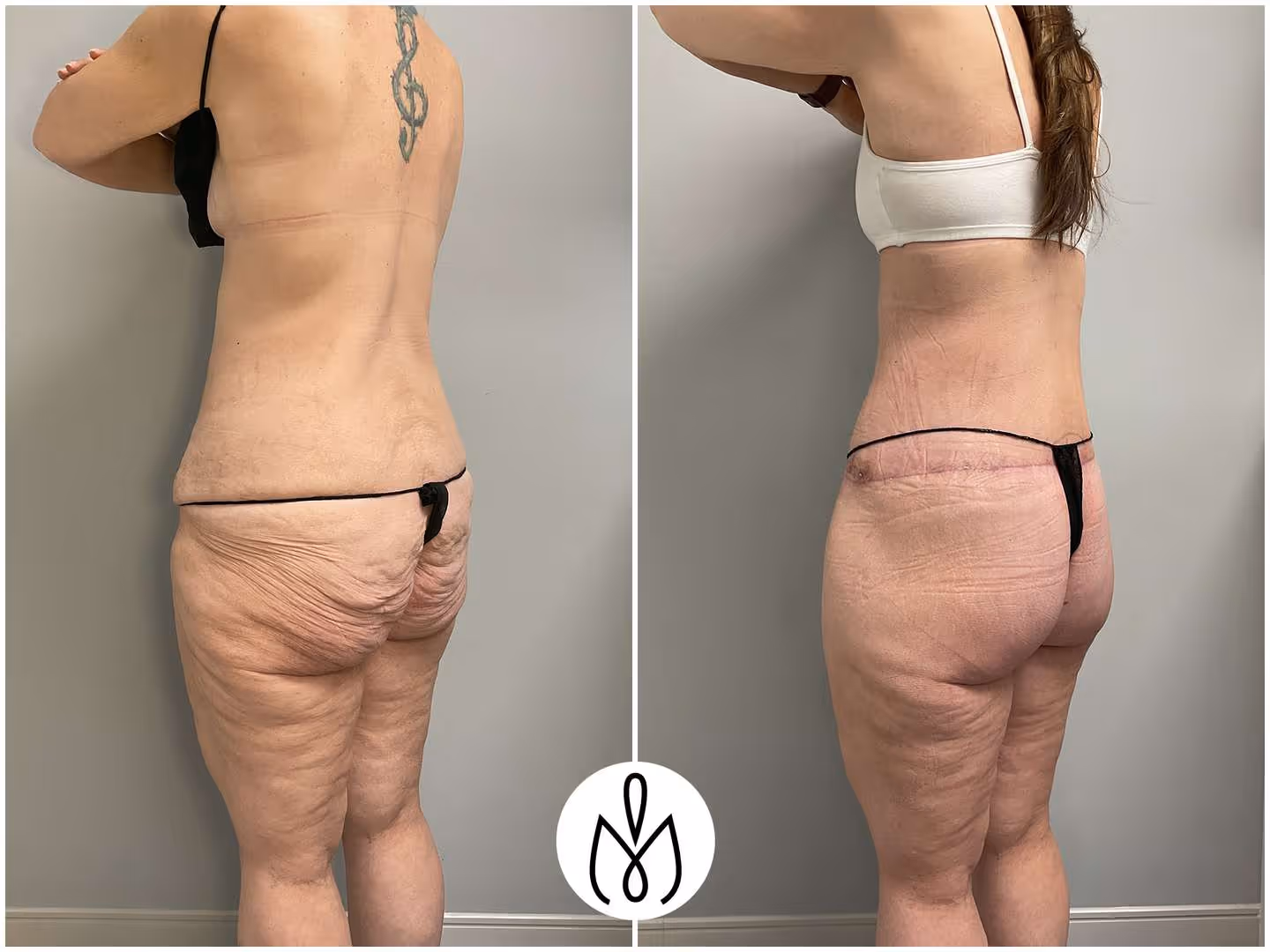 Before,After