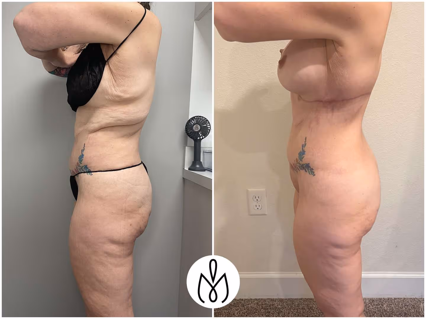 Before,After