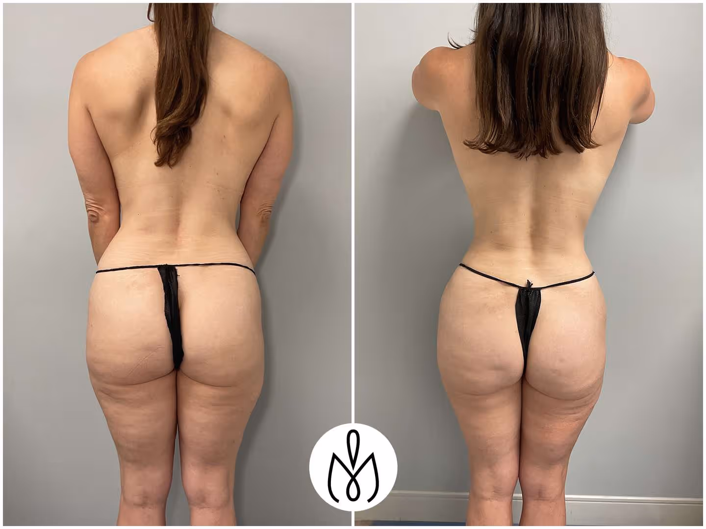 Before,After