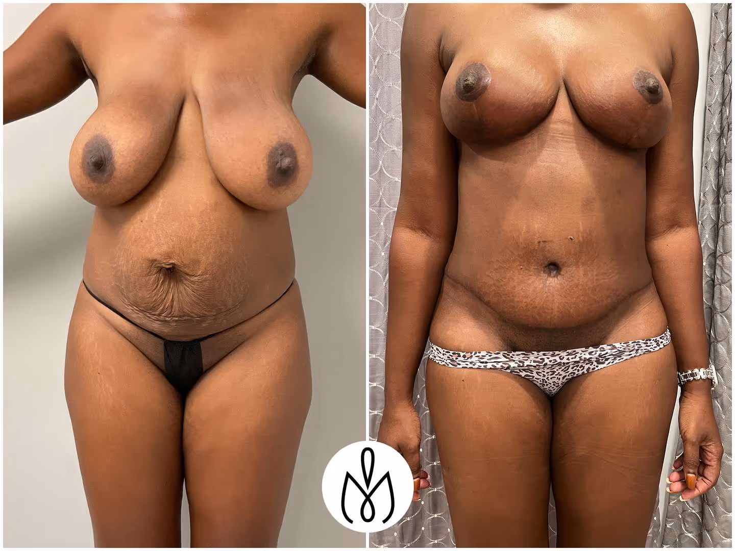 Before,After