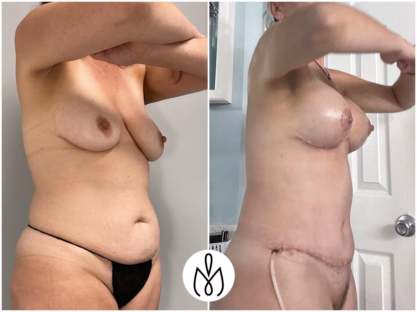 Before,After