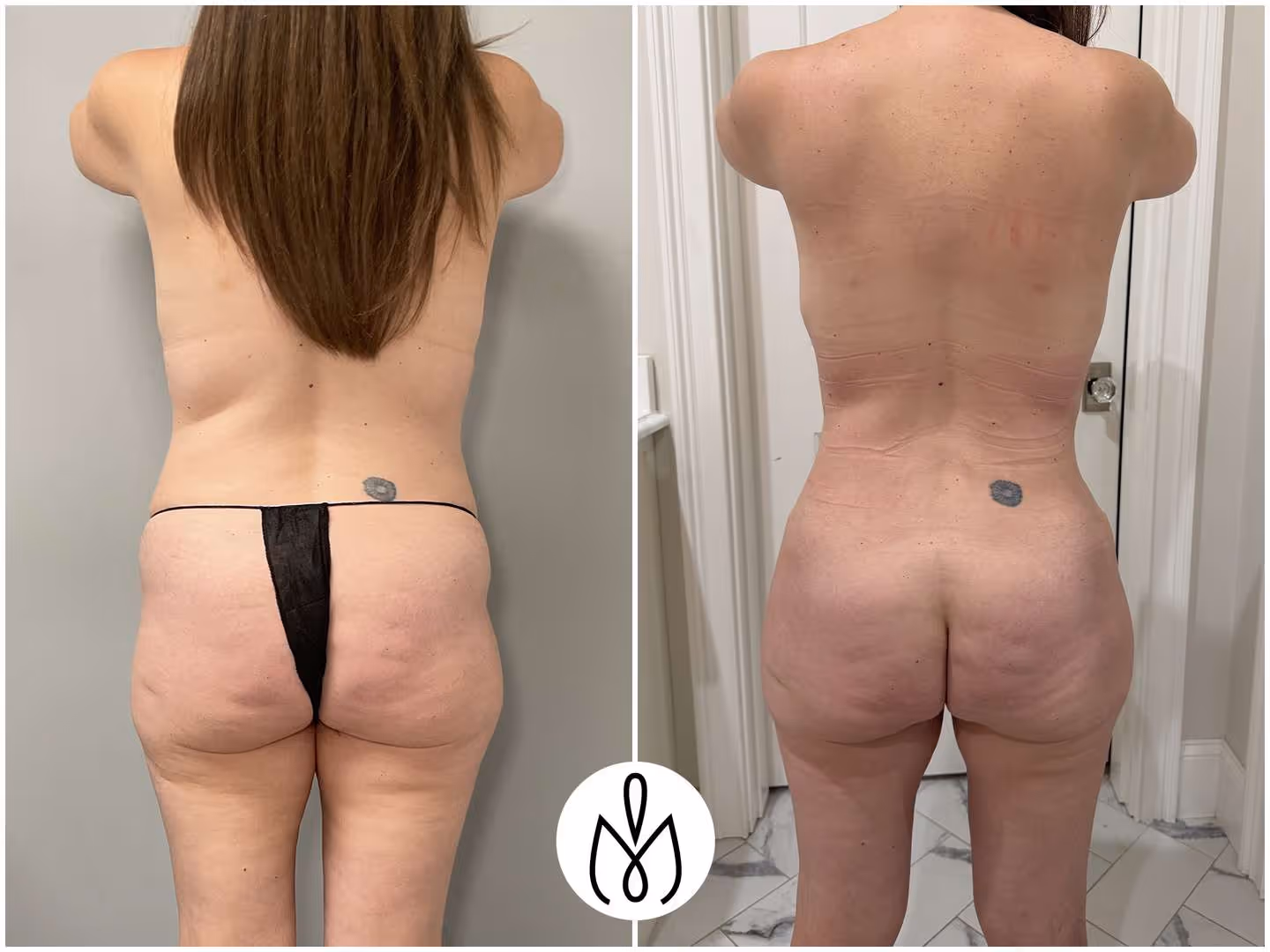 Before,After