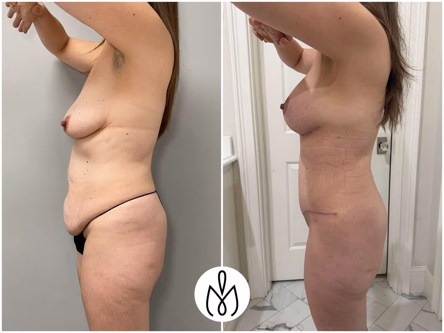 Before,After