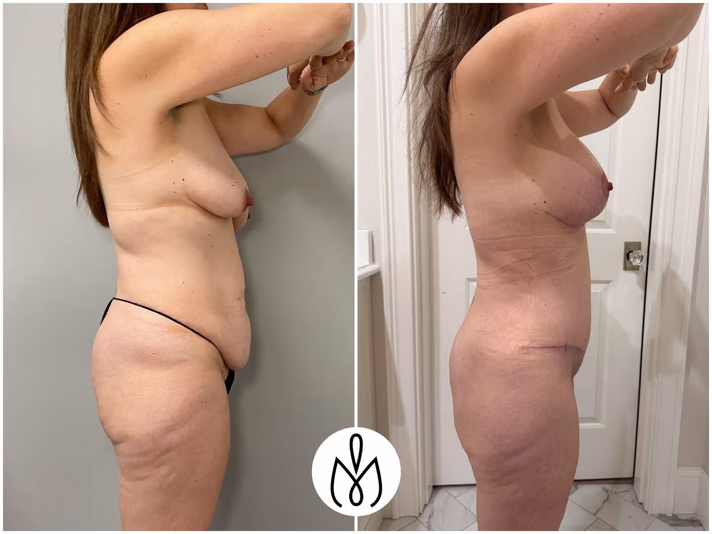 Before,After