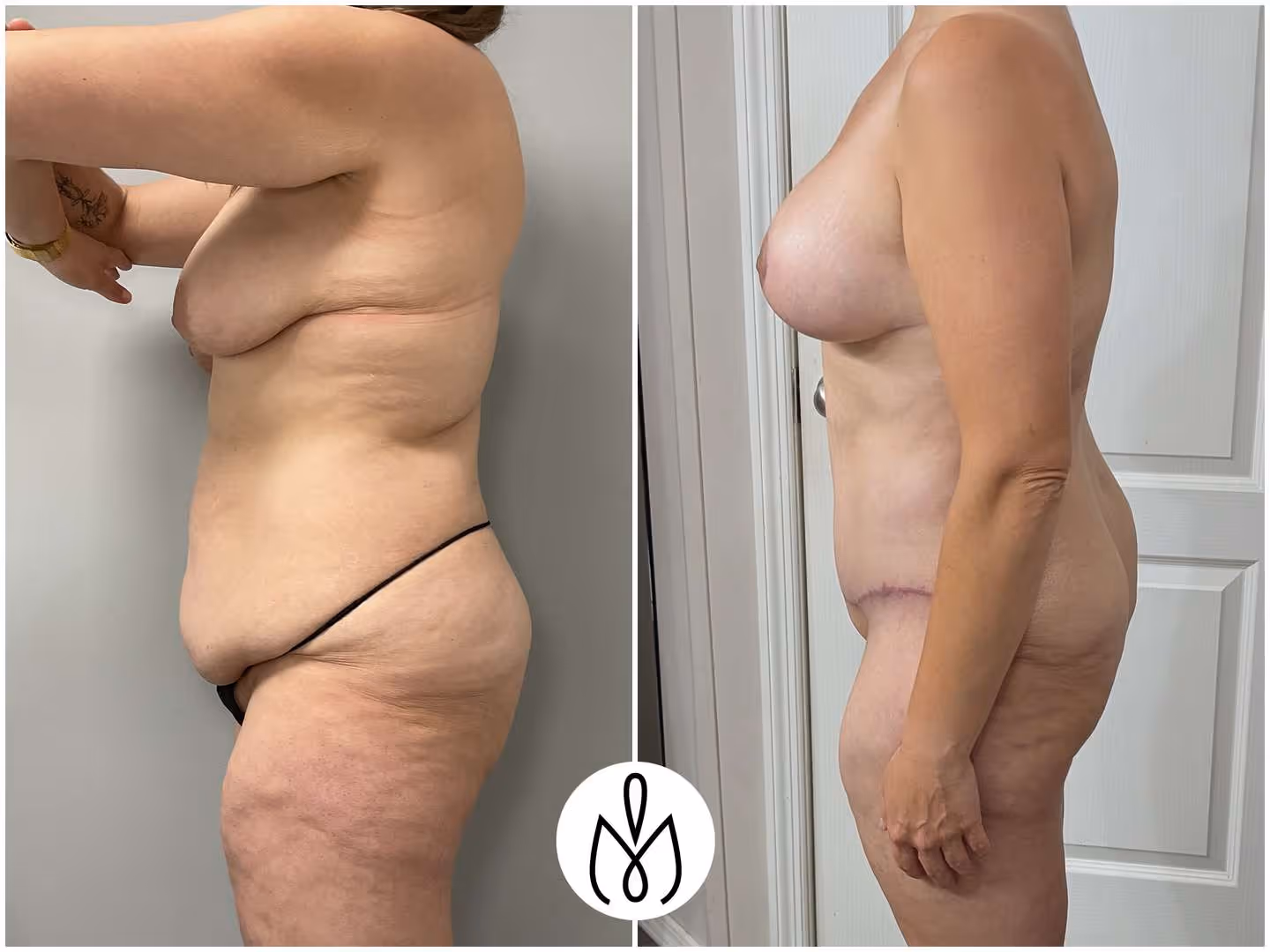 Before,After