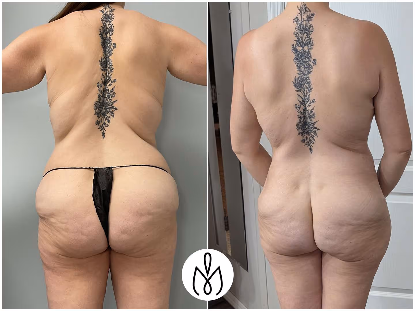 Before,After