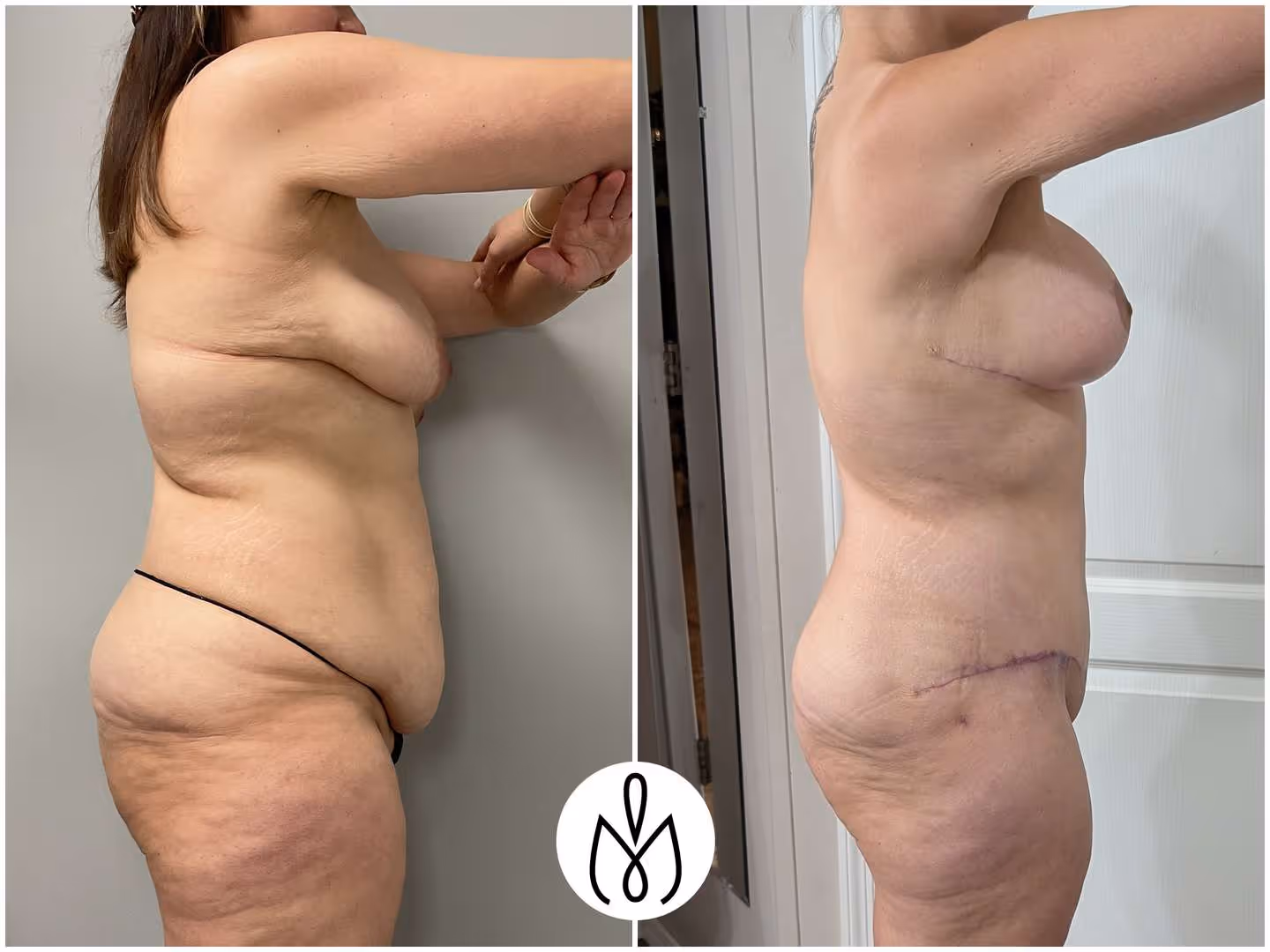 Before,After