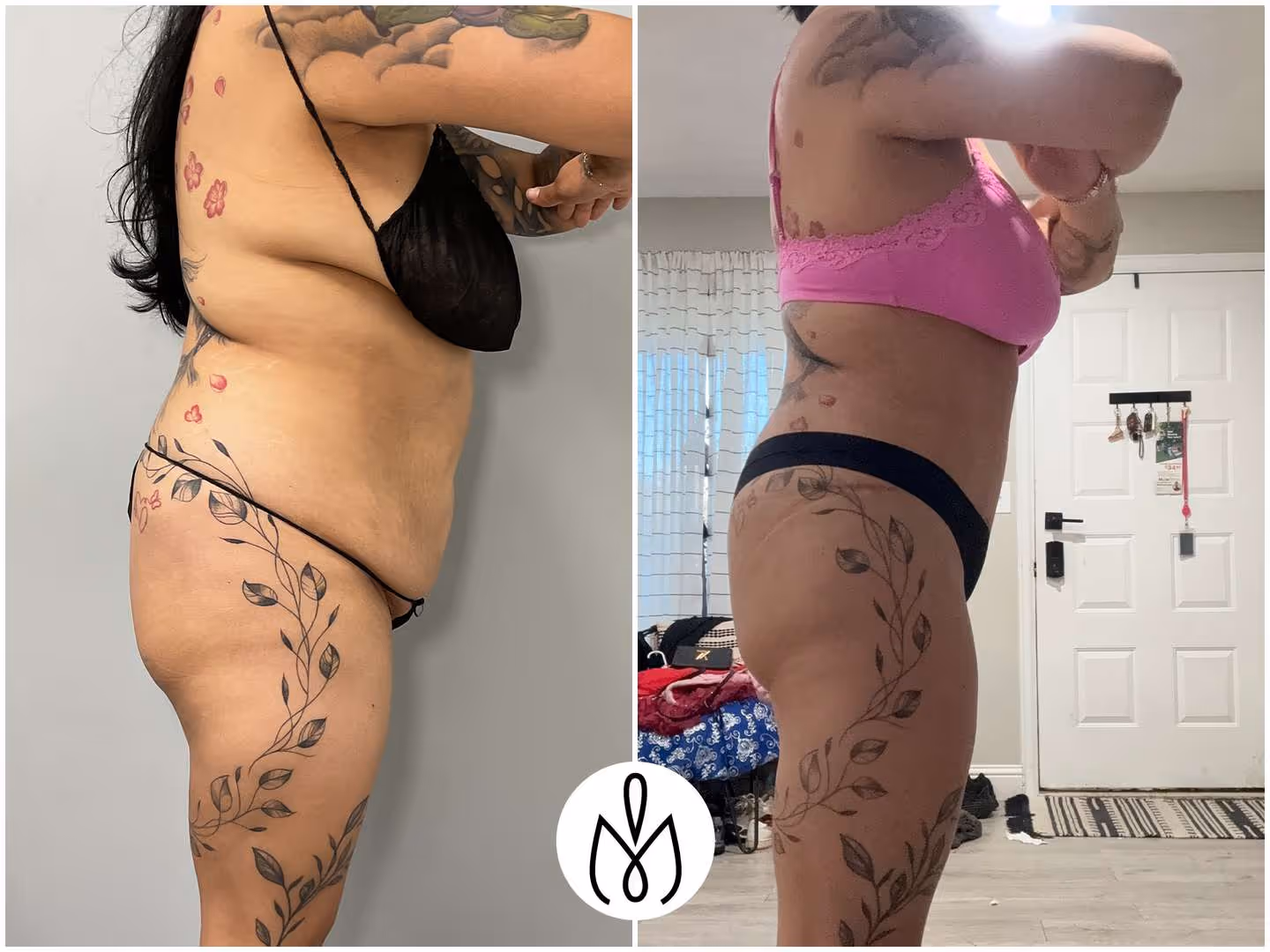 Before,After