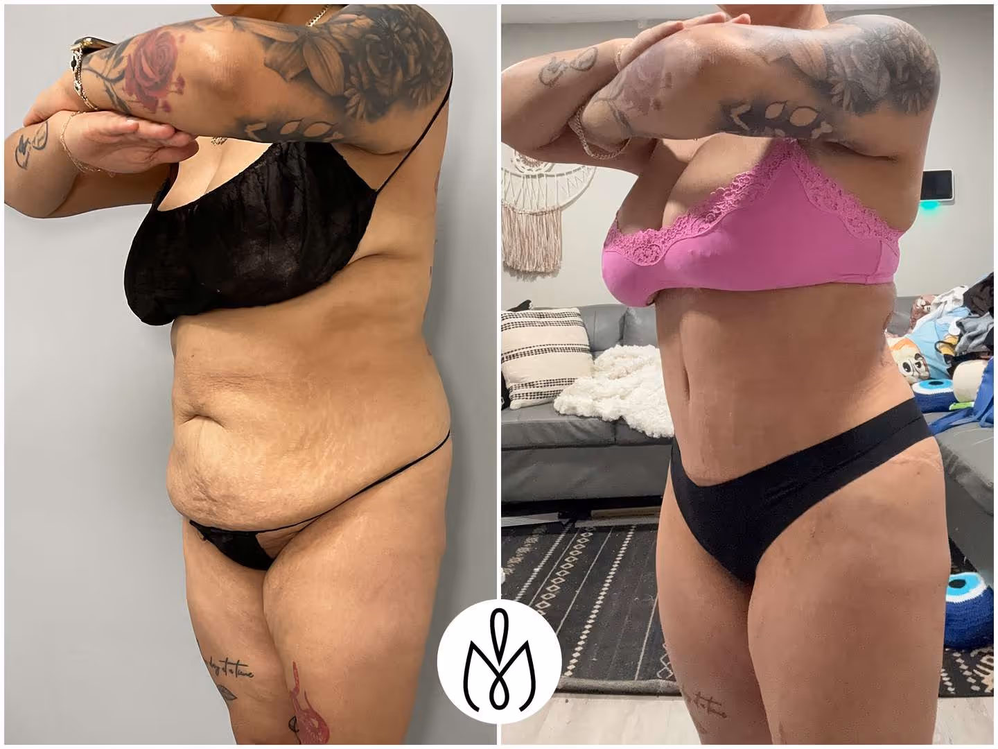 Before,After