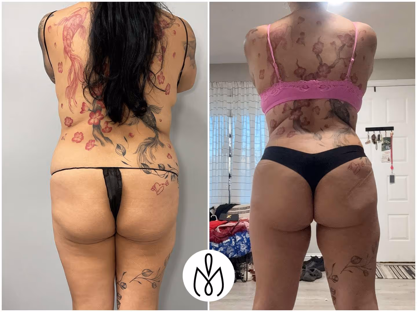 Before,After