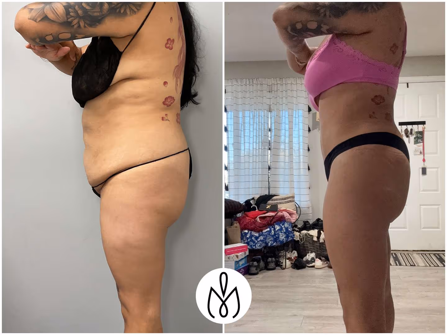 Before,After
