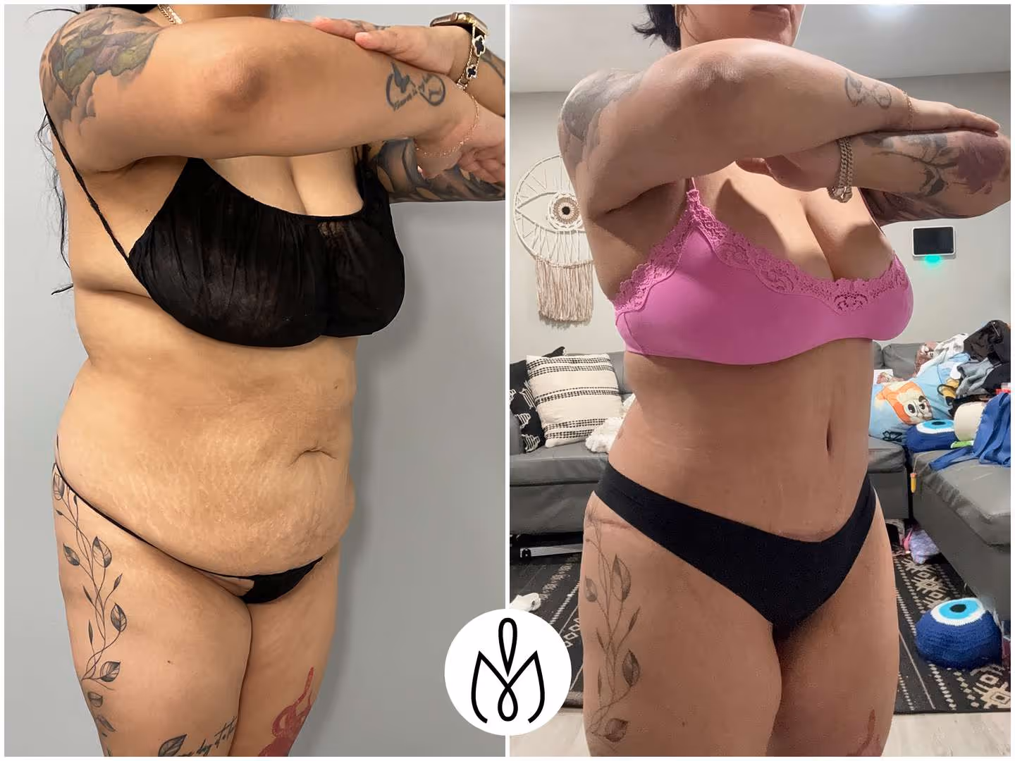Before,After