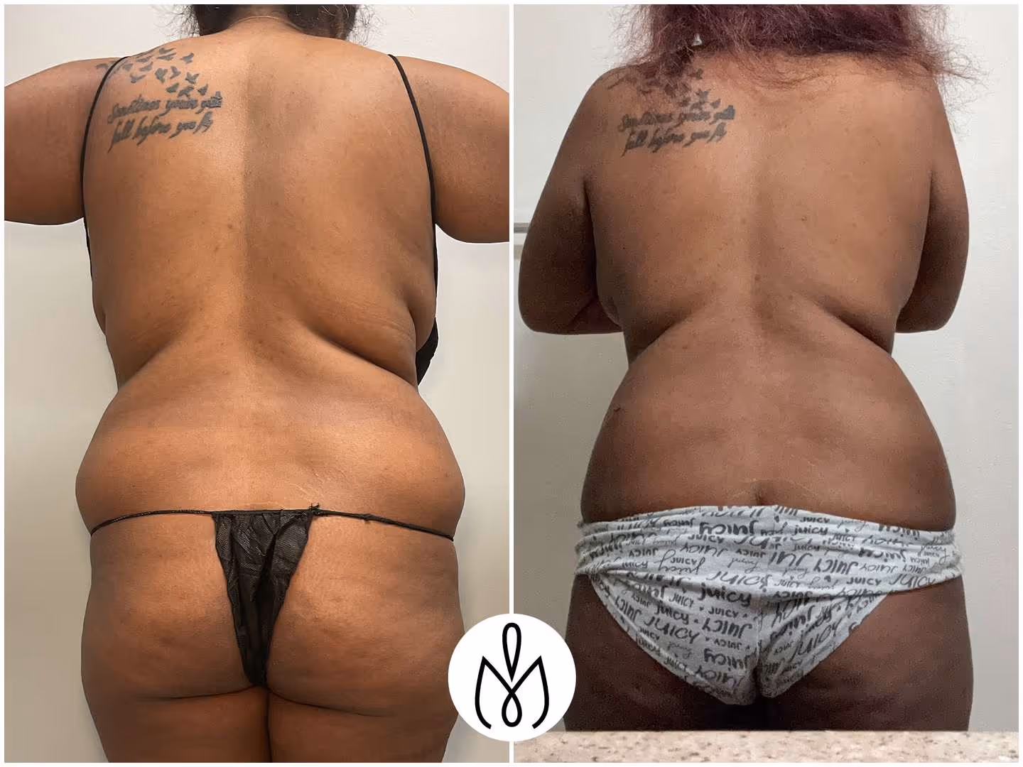 Before,After