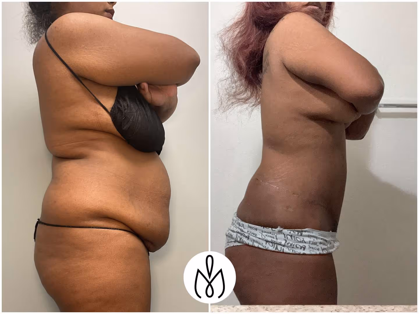 Before,After
