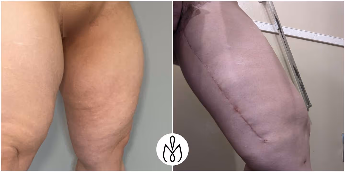 Before,After