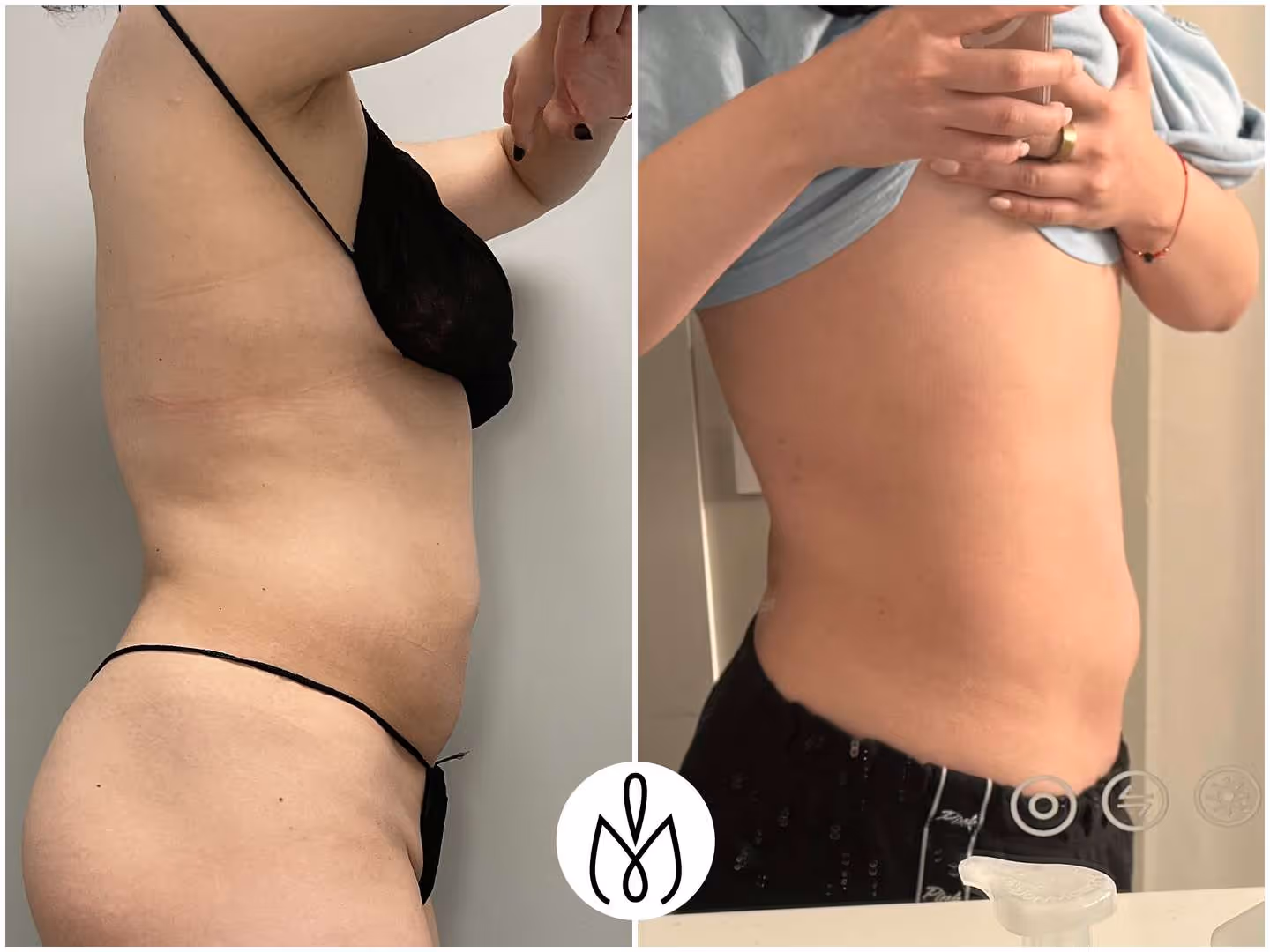 Before,After