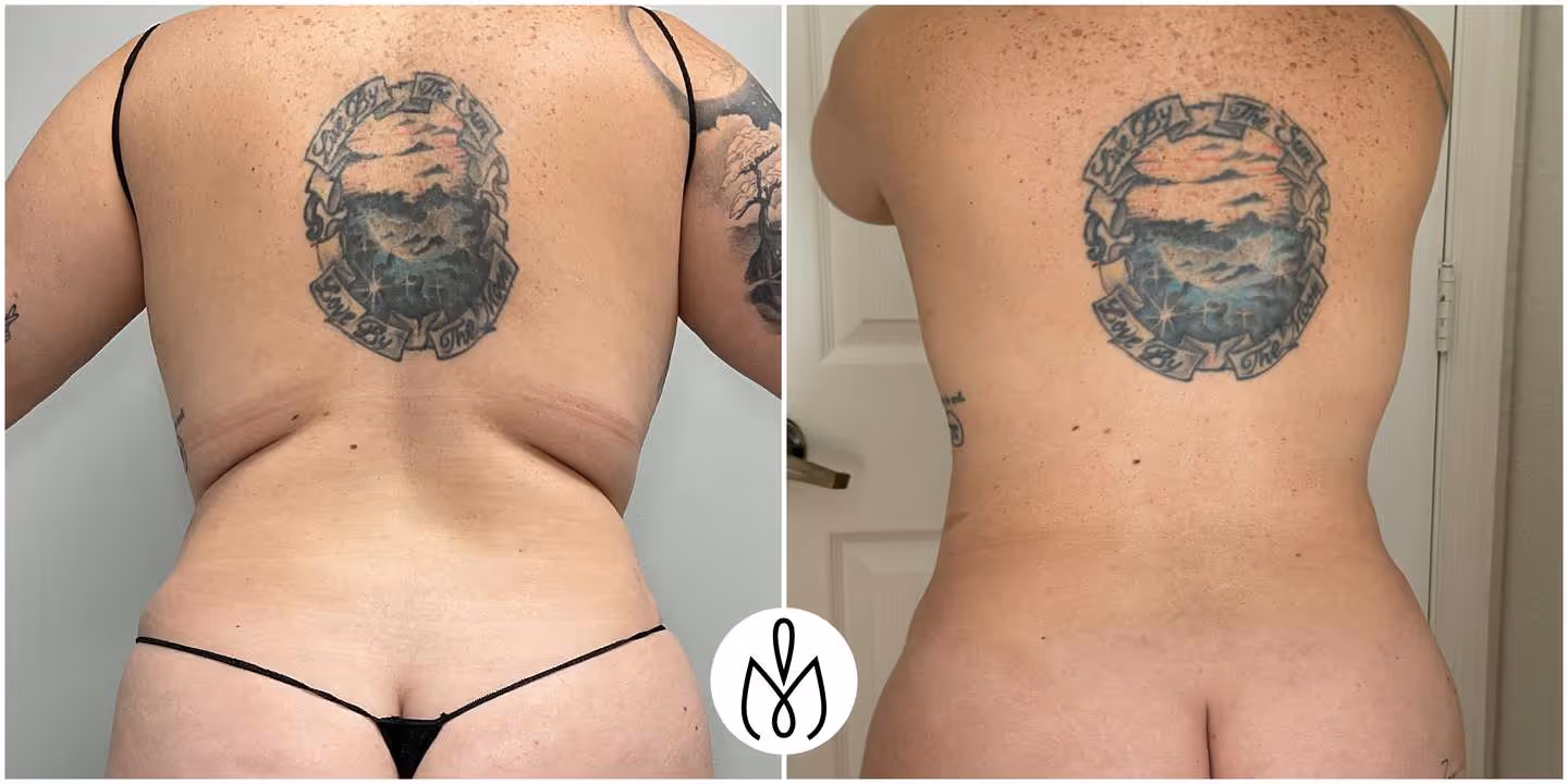 Before,After