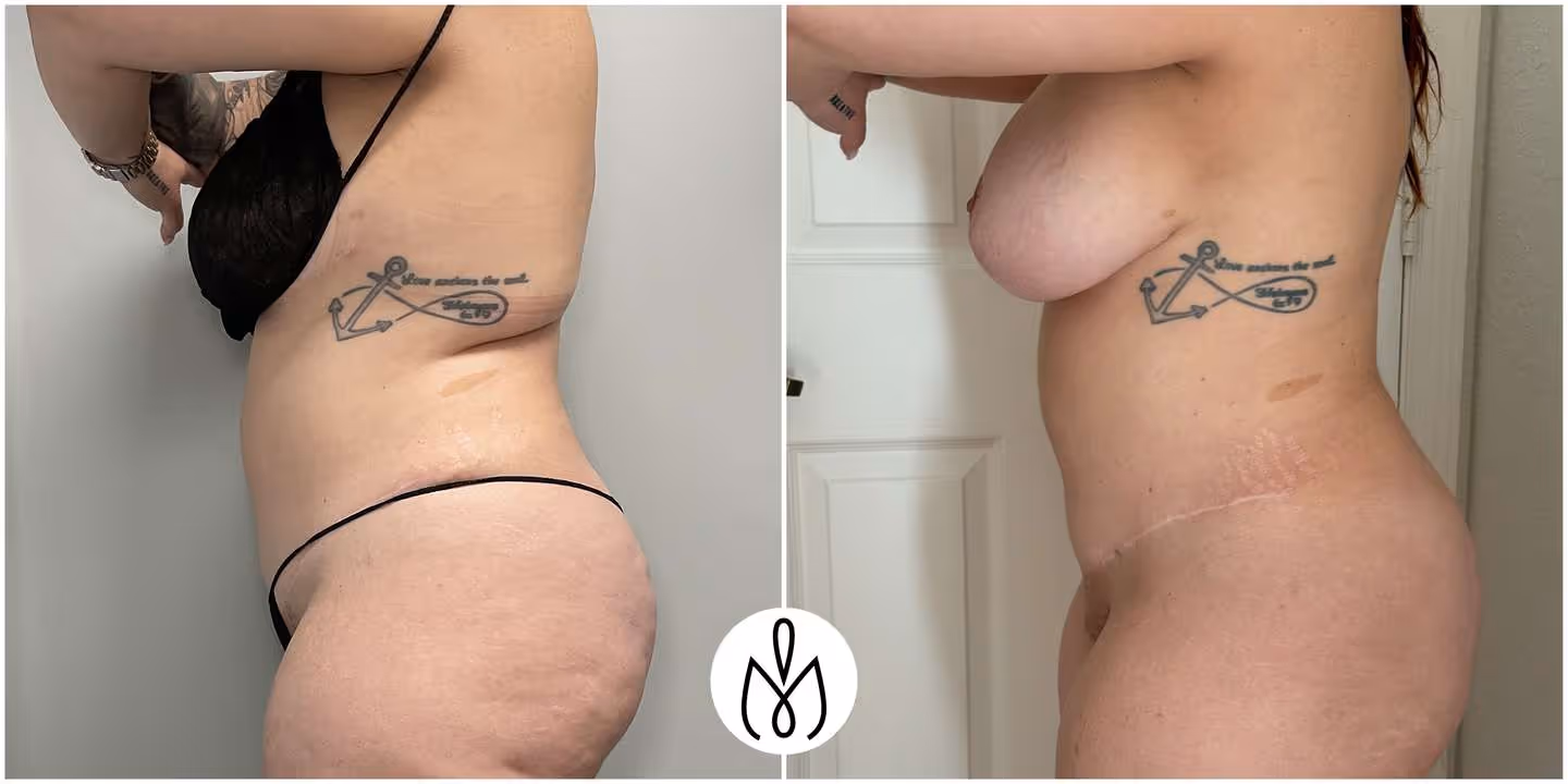 Before,After