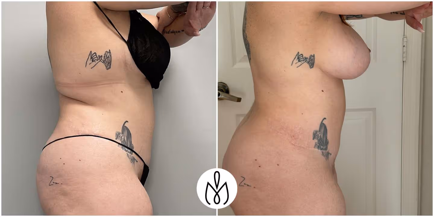 Before,After