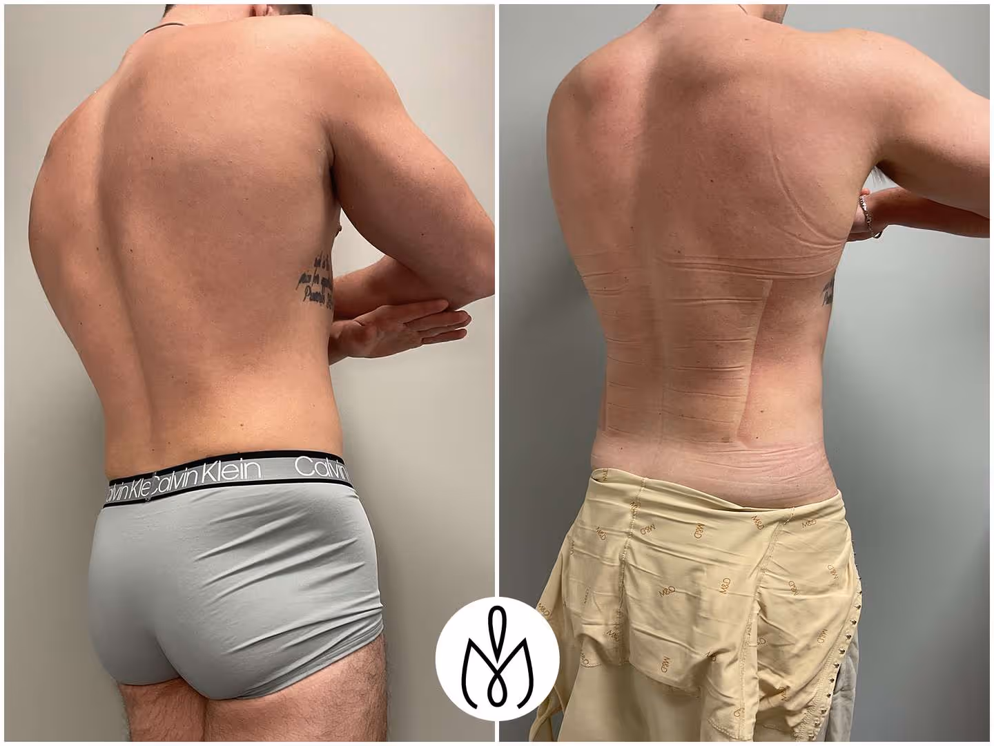 Before,After