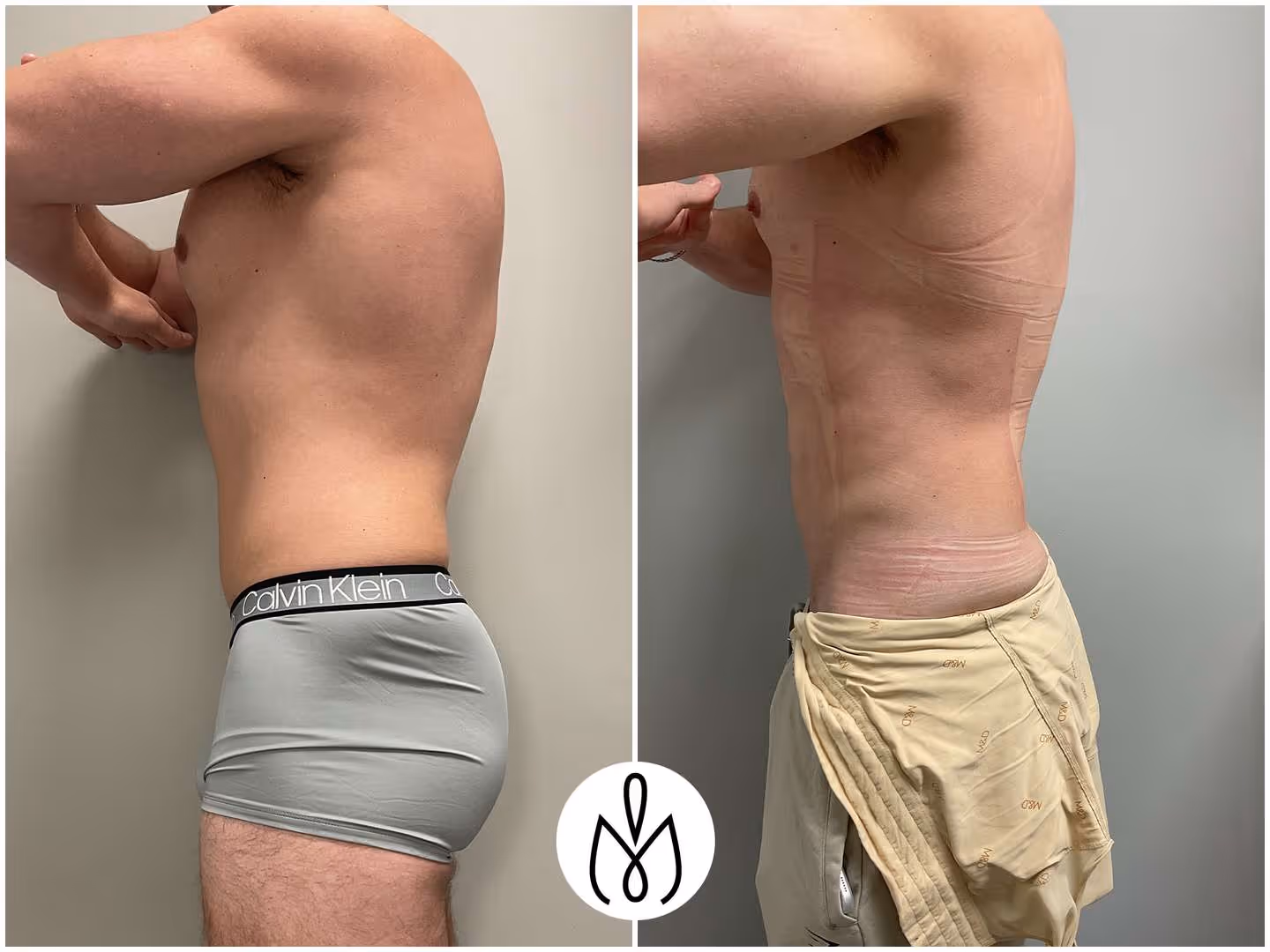 Before,After