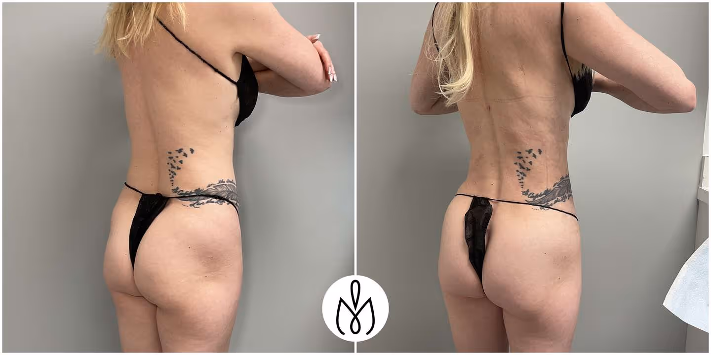 Before,After