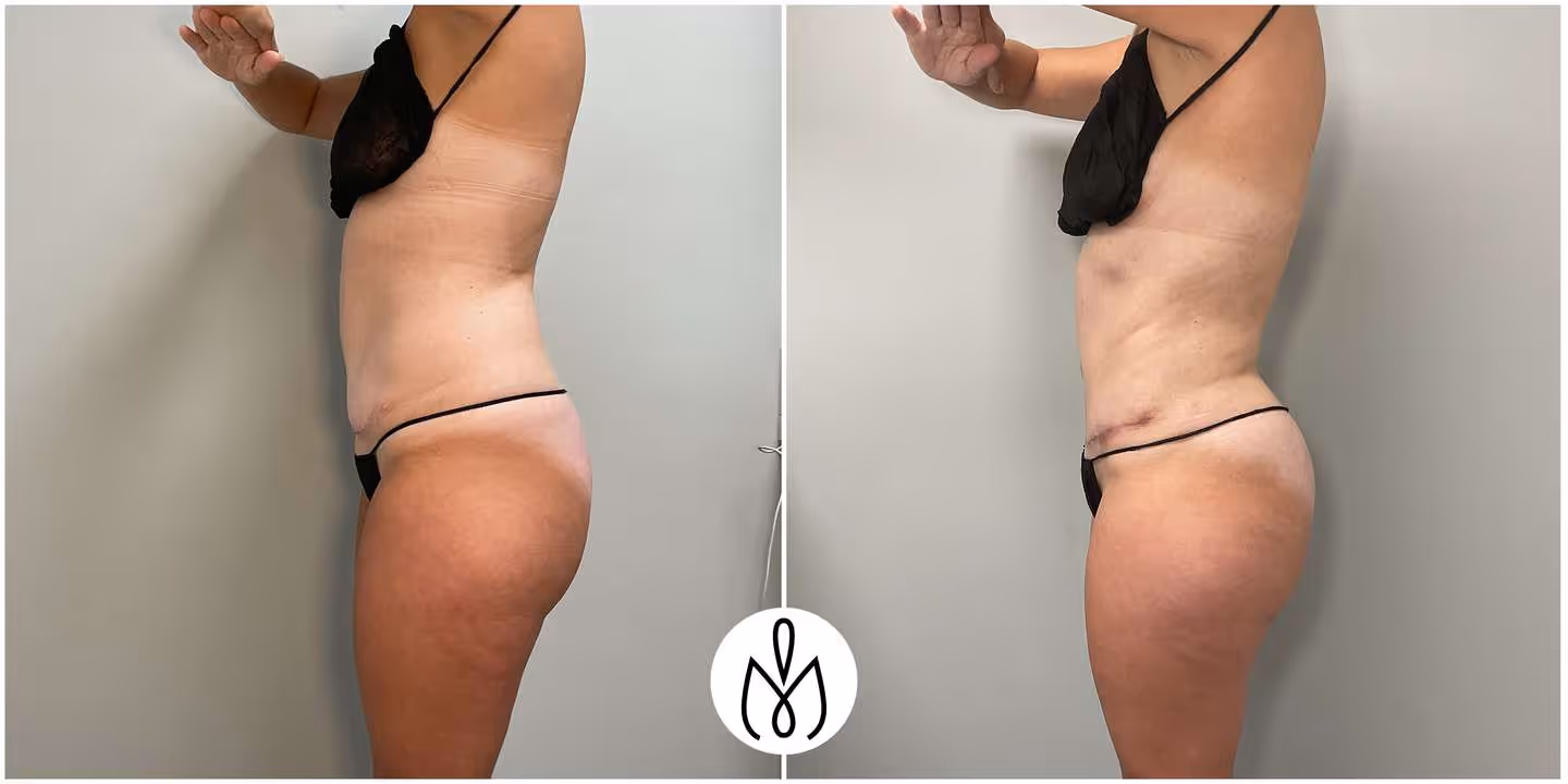 Before,After