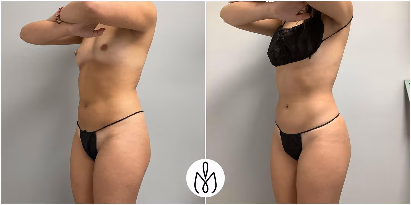 Before,After