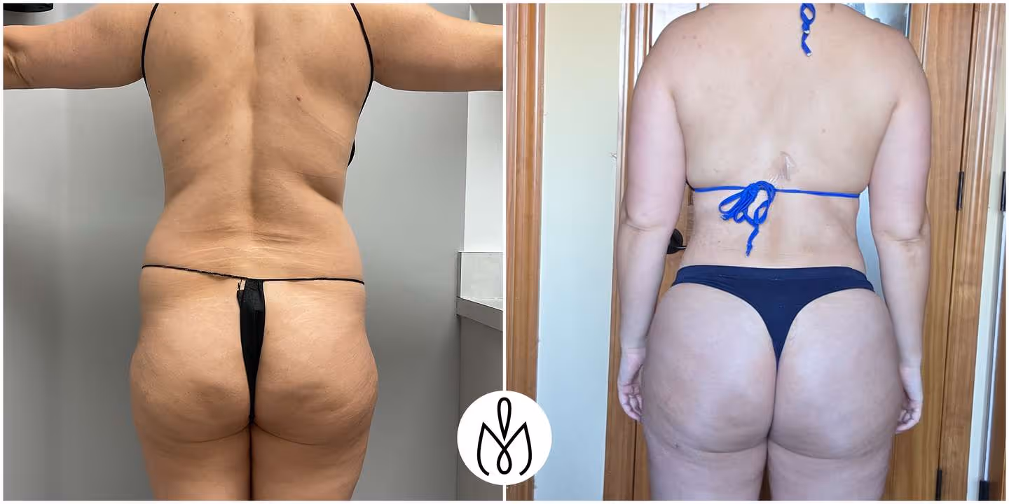 Before,After