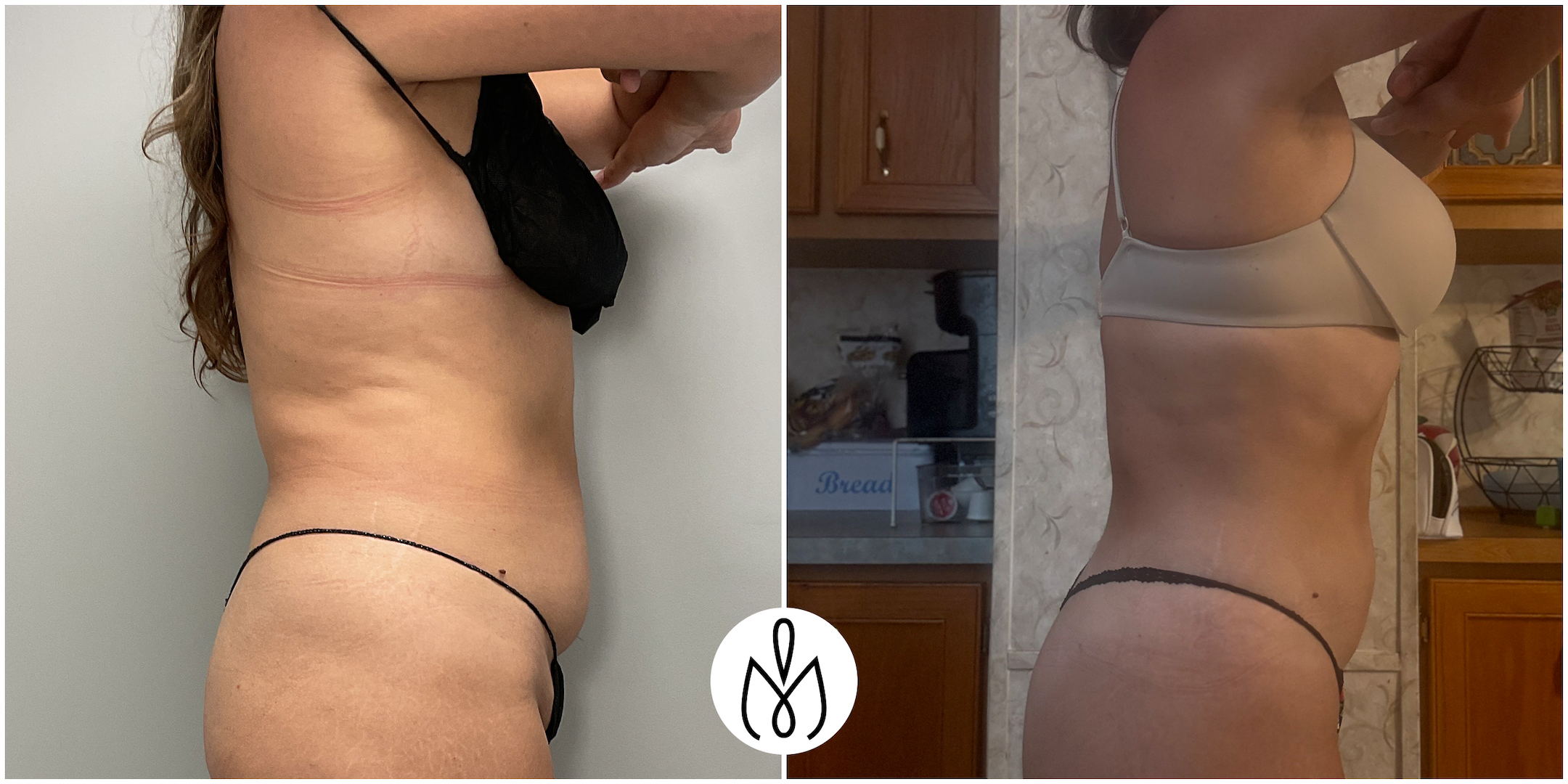 Before,After