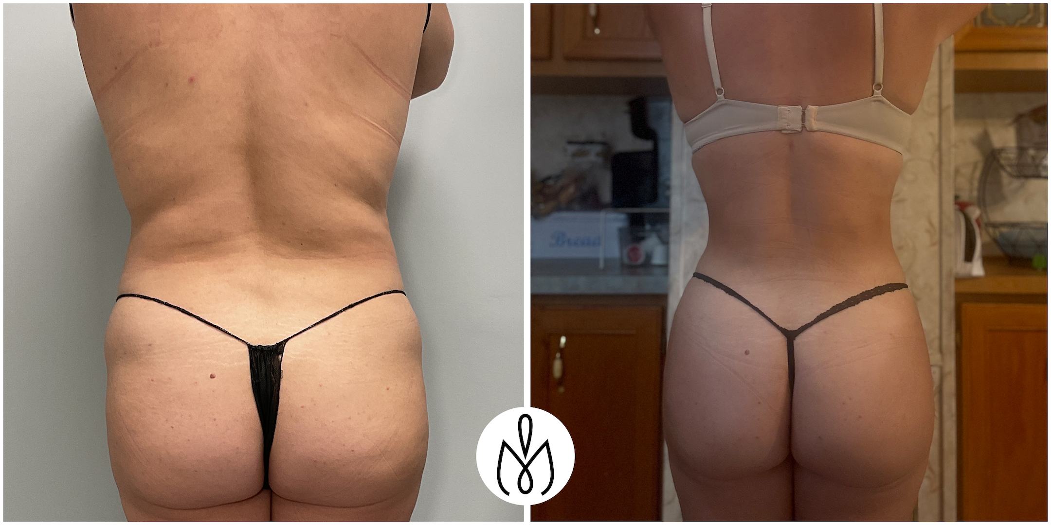 Before,After